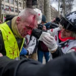 PROTESTER LOSES HAND