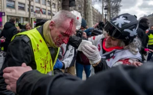 Read more about the article PROTESTER LOSES HAND